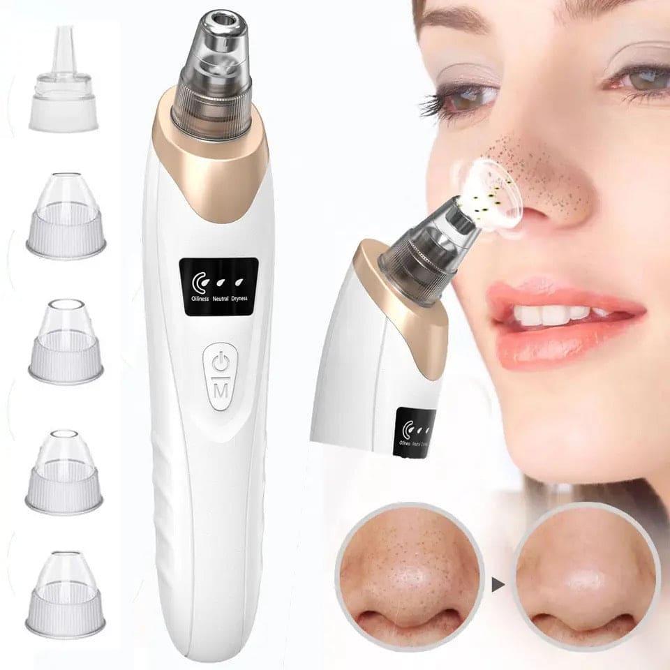 Battery Operated Blackhead Remover – Deep Pore Cleansing Tool