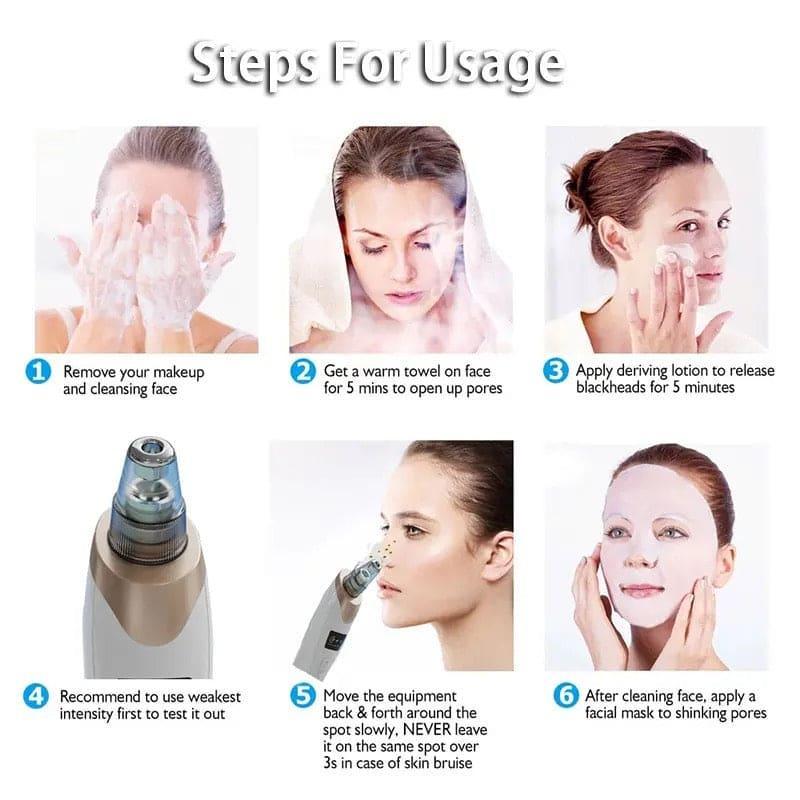 Battery Operated Blackhead Remover – Deep Pore Cleansing Tool